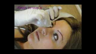 Permanent eyeliner  Makeup  Before and After  Tutorial by Redeem Clinic [upl. by Anihta]