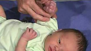 physical exam Newborn Normal Tone  Hand Position [upl. by Proud]