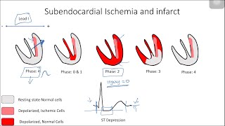 ST Elevation and Depression Electrophysiological Basis [upl. by Sheeb]