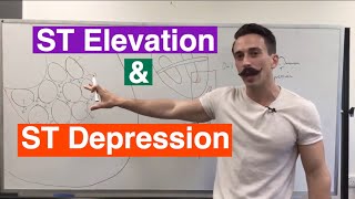 ST Elevation and ST Depression EXPLAINED [upl. by Haleelahk154]