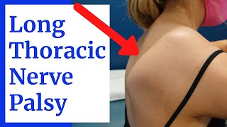 Does Your Patient Really Have Thoracic Outlet Syndrome TOS [upl. by Thaddeus220]